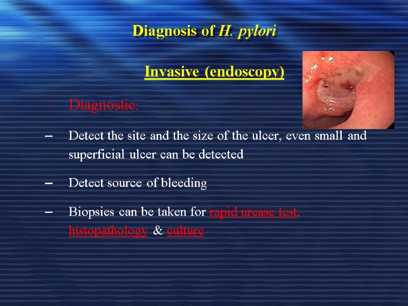 Diagnosis of H. pylori Invasive (endoscopy) Diagnostic: Detect the site and the size of